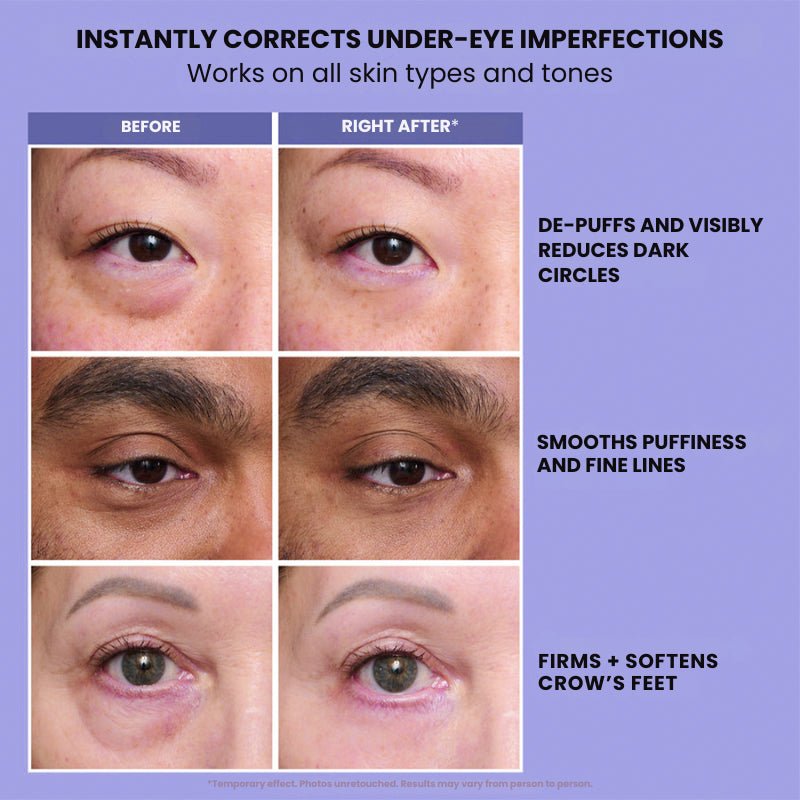 InstantLift+ Eye Tightener - InstantLift+